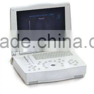 Hospital Clinical Equipment 15-inch Full Digital Laptop Ultrasound Scanner China Made Portable Ultrasound Machine photo-2
