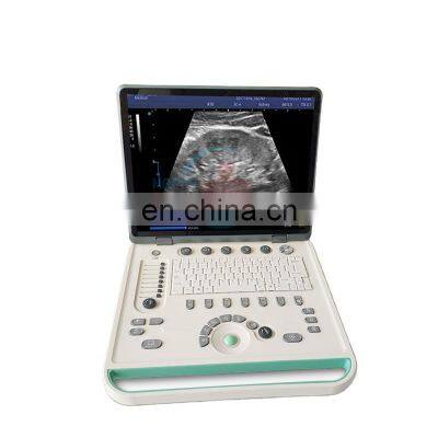 HC-A006A Top Full digital 15 inch PC based Laptop Ultrasound scanner with 3D function