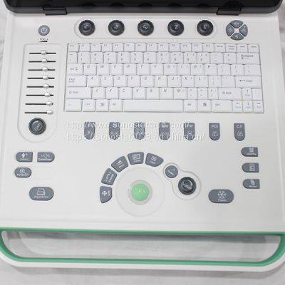 C5Pre Laptop Color Doppler photo-3