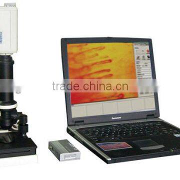 TR8000B Microcirculation Analyzer(Laptop Type)