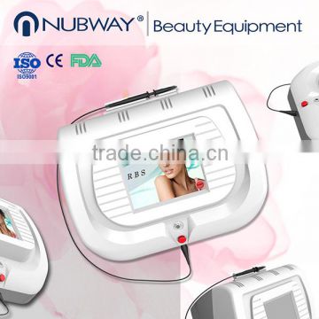 30MHZ Pain Free RBS Laser Blood Vessel Removal Machine spider vein removal