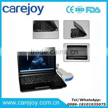 Carejoy Laptop Ultrasound machine ultrasonic diagnostic system RUS-9000F with CE certification