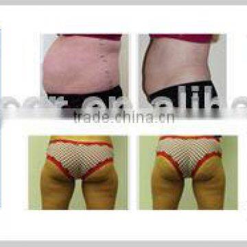 Body Contouring Equipment photo-4