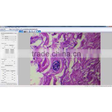ZX-117M(03) Professional Biological Microscope photo-4