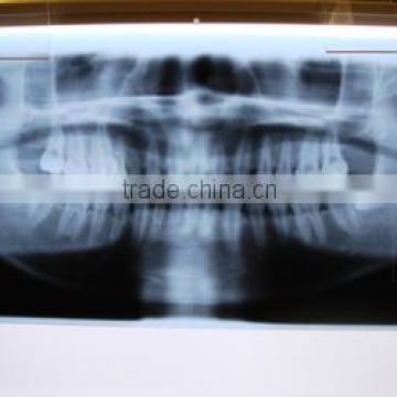 china medical x ray dental film with ISO 13485 and CE