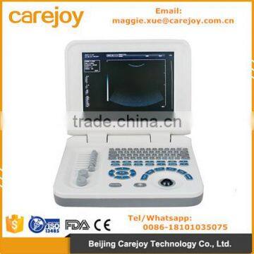 Carejoy laptop Ultrasound Scanner with multi frequency probe ultrasonic diagnostic system RUS-9000F2