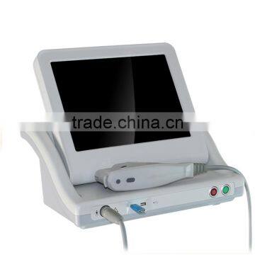2016 Hottest!!! Anti-wrinkle High Intensity Focused Ultrasound Knife photo-2