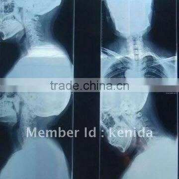 Konida industrial x-ray film,printed with fuji thermal printers