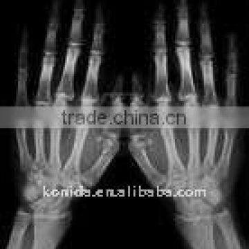 x-ray machine accessories,dry image films,medical x-ray film