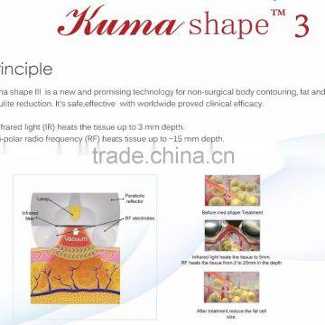 Kumashape Safe and Enjoyable Slimming IR RF Vacuum Rolling Massage Beauty Device