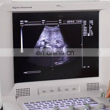 MY-A005 B Ultrasound Diagnostic System Hospital cheapest portable ultrasound machine