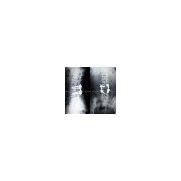 medical laser-jet film, medical matte film, medical dental film
