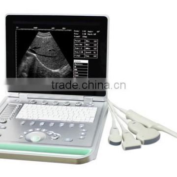 Laptop ultrasound machine scanner for Pregnancy test SS-7 model