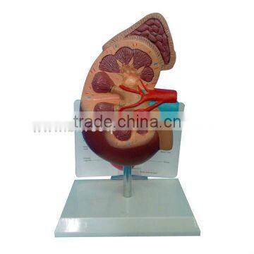 Kidney Model