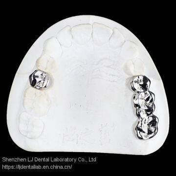 Full Metal Crown, FMC, FGC, Full Metal Post Core, Dental Crown, Cast Metal Crown, Dental Prosthesis, Laboratorio Dental, Dental Laboratory, Dentallabor, LJ Dental Lab China photo-4