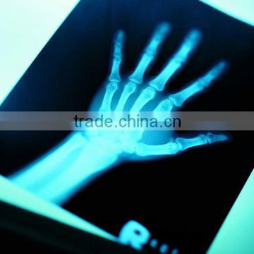 fuji x-ray film, medical x-ray film agfa of chinese medical equipments