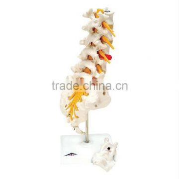 Lumbar model with cheap price