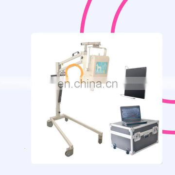 China High Quality Touch Screen  MY-D019D Hospital Digital Portable Mobile X-ray Machine/X-ray Unit/X-ray System