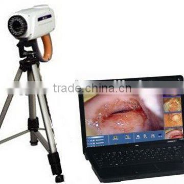 portable digital electronic colposcope with laptop