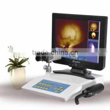 Infrared Mammary Tester for woman