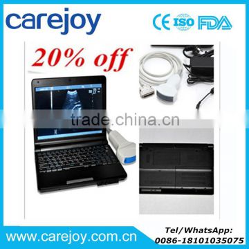 CE Approved LCD 10.4 inch Laptop Ultrasound machine RUS-9000F with battery with cheap price