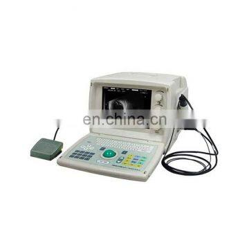 YODM-2100 Ultrasound A/B Scanner for Ophthalmology