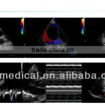 High quality 3D & 4D color doppler ultrasound system