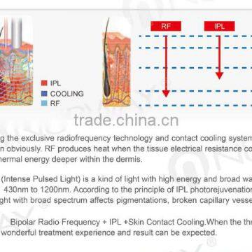 New Shr Ipl Equipment for Distributor Vertical IPL SHR&E-light Hair Removal Equipment&machine