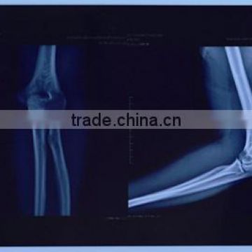 14*17 Dry blue DRY hospital film medical x-ray film for digital CR DR