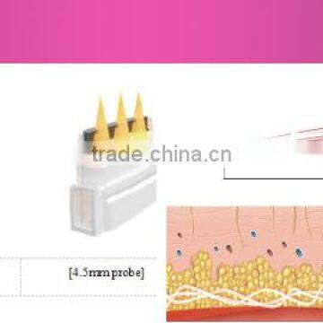 Chest Shaping 2016 New Home Use HIFU 1.0-10mm Machine Price Face Lift HIFU photo-5