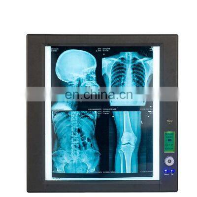 Medical Induction and Adjusting Light Single and Two Brank X-ray Film Viewer
