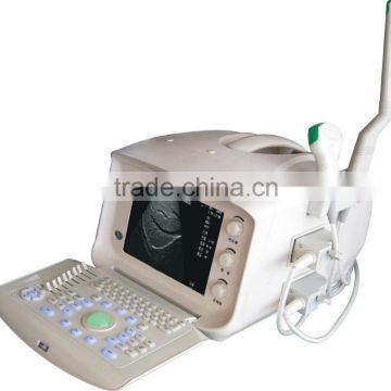 High-quality Digital Veterinary Used Ultrasound