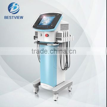 popular lipo machine new laser 650nm