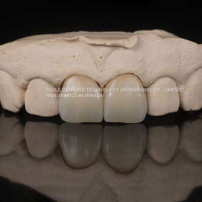Digital-Crowns-Bridges Dental Laboratory in China photo-3