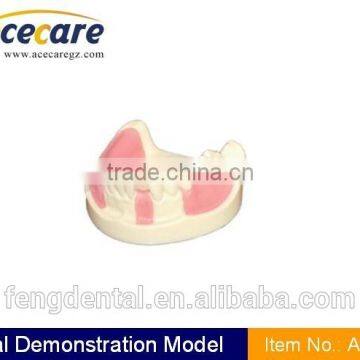 dental supply quality Implant practice model AC-P8