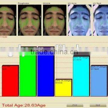 uv Light Skin Analyzer /reveal Skin Analysis Machine photo-3