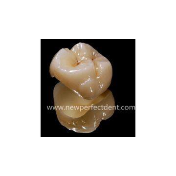 Dental lab Zirconia porcelain denture