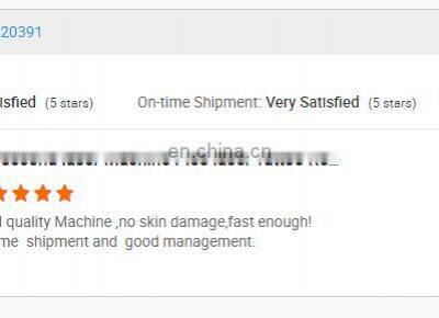 Picosecond Tattoo Removal Laser Beauty Equipment Popular q Switched nd Yag Laser Machine for Sale photo-4