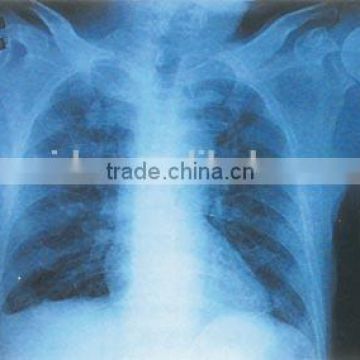 agfa film dt2b, medical x-ray film agfa of medical equipment wholesale