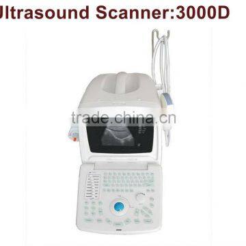 Wholesale Portable Digital High Quality Ultrasound Scanner photo-6