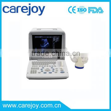 Promotion!CE approved Portable B-Mode Ultrasound Scanner with 3.5Mhz multi-frequency convex probe RUS-9000B