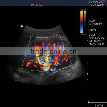 New Type Laptop Color Doppler Ultrasound for Human With Laptop photo-6