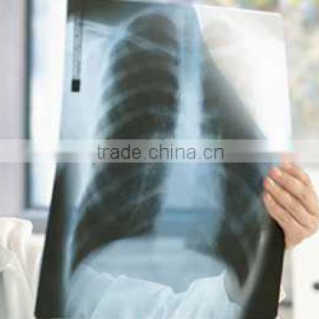 medical thermal x ray film,film manufacturer ,dental x-ray film