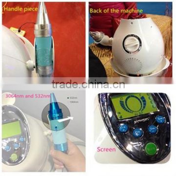 2015 q switch laser tatoo removal/nd yag laser/eyebrows/age spot removal