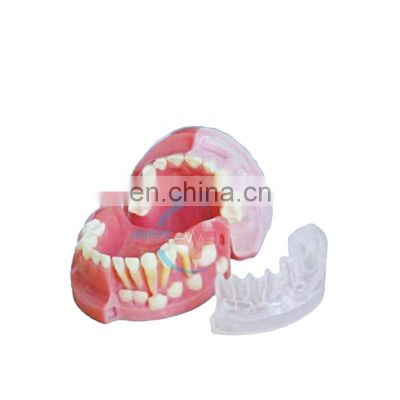 HC-S421 Dental teaching model dental teeth model three year-old primary teeth anatomical teaching model