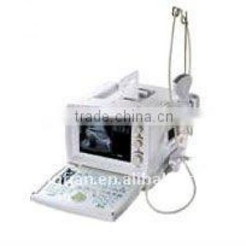 B ultrasound equipment