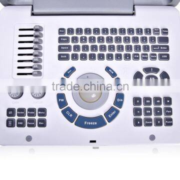 Cheapest Full Digital Ultrasound Scanner/ultrasound /ultrasonic Diagnostic Machine Device 2018CI