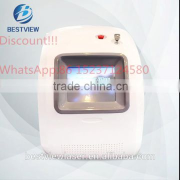 Promotions!!!fast spider vein removal machine portable 980nm diode laser,vascular therapy portable 980nm diode laser