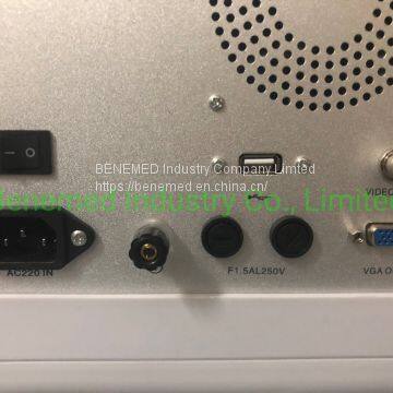 Portable B/W Ultrasound Scanner With High Quality photo-5