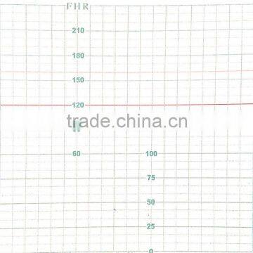 Fetal Monitor Paper / 112mm*100mm-150p Fetal Monitor Recording Paper for Mindray